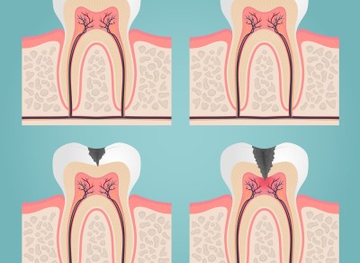 Endodontie