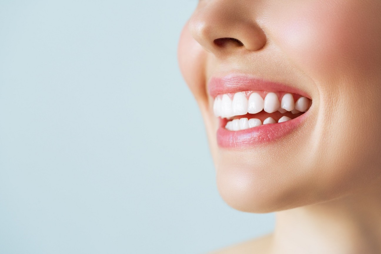 Smile Teeth Whitening | Bleaching